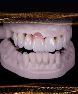 High-quality dental restorations for lasting results